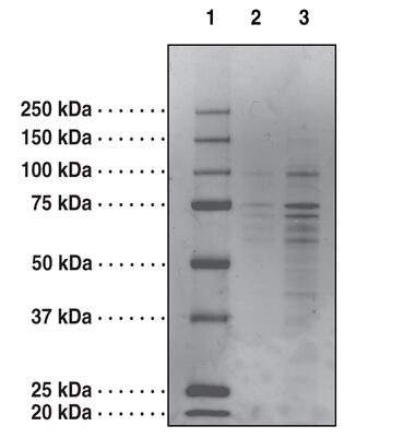 Lane 1: MW Ladder<br />Lane 2: PTGS1 (2 μg)<br />Lane 3: PTGS1 (5 μg)